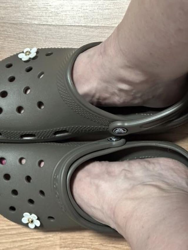 Crocs review image 1