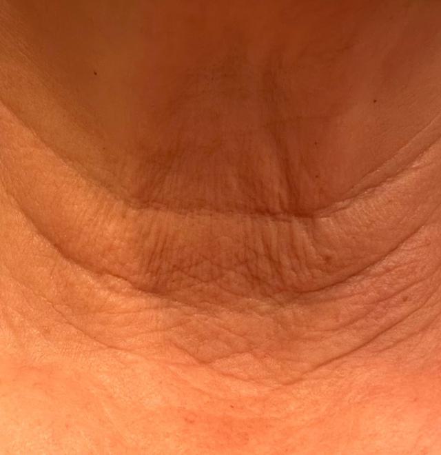 Before using goPure Neck Firming Cream