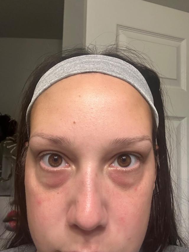 After using Maybelline Instant Age Rewind Concealer