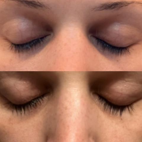 Lash Growth After Use